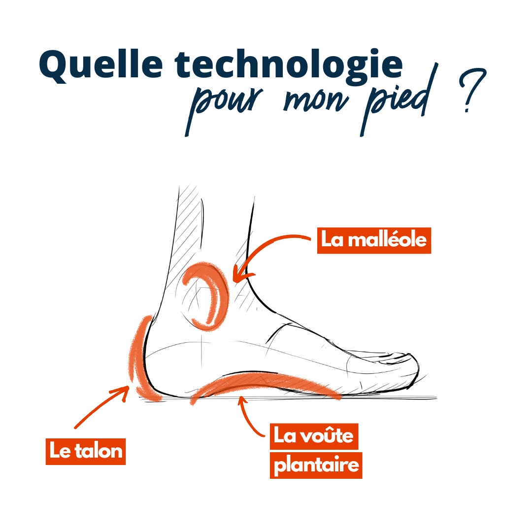 Schema quelle technologie pour mon pied